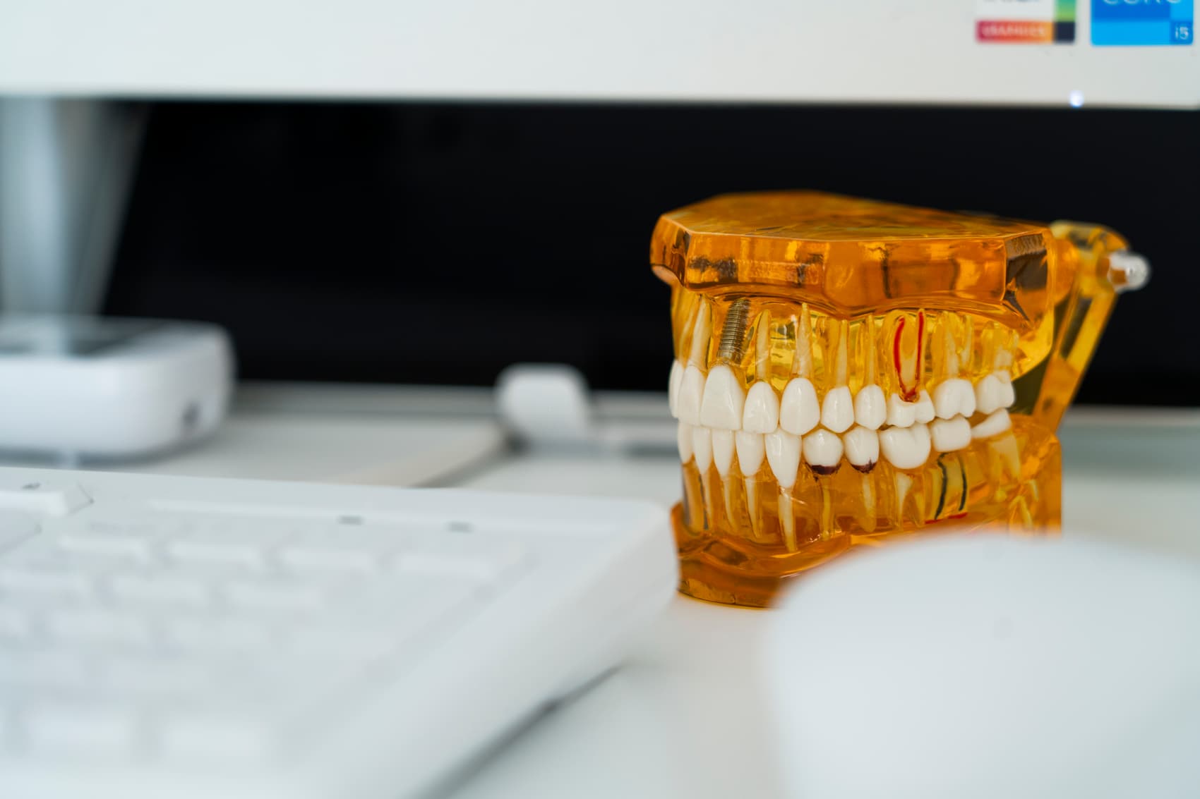 Clínica Dental Enso dentadura